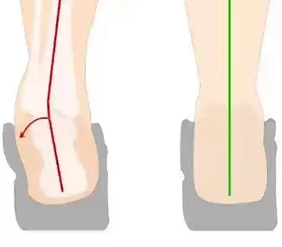 Đánh giá đảo gót và đảo ngược gót chân: Đánh giá lâm sàng, ứng dụng thực tế và hội nhập thương mại