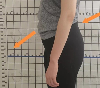 Đánh giá độ nghiêng xương chậu sau: Cái nhìn sâu sắc về lâm sàng, giá trị thương mại và ứng dụng ...