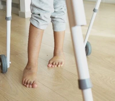 Sự khác biệt về chiều dài chân: Tìm hiểu sự mất cân bằng, nhận biết tác hại và tìm ra sự rõ ràng ...