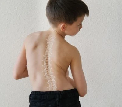Thời gian sử dụng thiết bị có định hình lại cột sống của một thế hệ không?