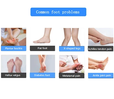 Cách mạng hóa việc chăm sóc bàn chân: Máy quét bàn chân 3D của Xianku giúp cải thiện chỉnh hình v...