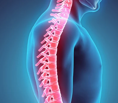 Chỉnh sửa cột sống:Giải pháp cột sống kỹ thuật số-không cần bức xạ