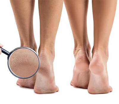 Bước vào tương lai: Công nghệ quét bàn chân 3D đang cách mạng hóa việc chăm sóc bàn chân như thế nào