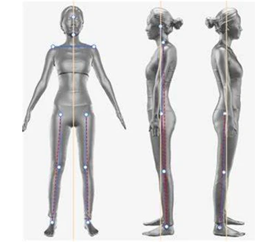 Tư thế đầu hướng về phía trước, nghiêng xương chậu và bạn: Máy quét cơ thể 3D cho phép điều chỉnh...
