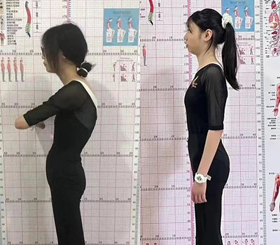 Quét tư thế 3D Vs. Đánh giá truyền thống: Tại sao mắt thường bỏ sót những vấn đề quan trọng